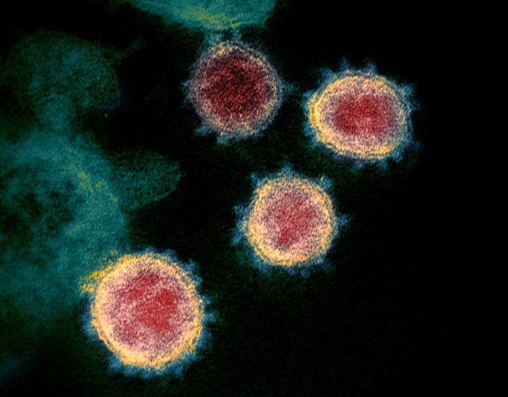 Lamont: total coronavirus cases in Connecticut now 5,276; 165 dead